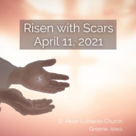 Sermon for April 11, 2021: Risen with Scars